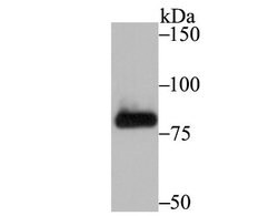 Muscle Phosphofructokinase/PFKM/PFK-1 Rabbit anti-Human, Mouse, Rat, Clone: